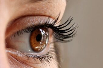 Die Oberlidstraffung ist der zweithäufigste Eingriff in der ästhetisch-plastischen Chirurgie in Deutschland.